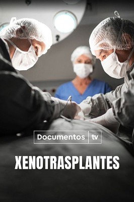 Xenotrasplantes